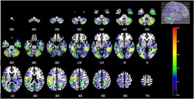 A New Insight on the Role of the Cerebellum for Executive Functions and Emotion Processing in Adults